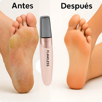 Removedor Eléctrico de Callos Profesional + Regalo Sorpresa 🎁